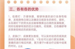 伍德灯检查是检查什么 - 体坛新闻分类下的文章配图